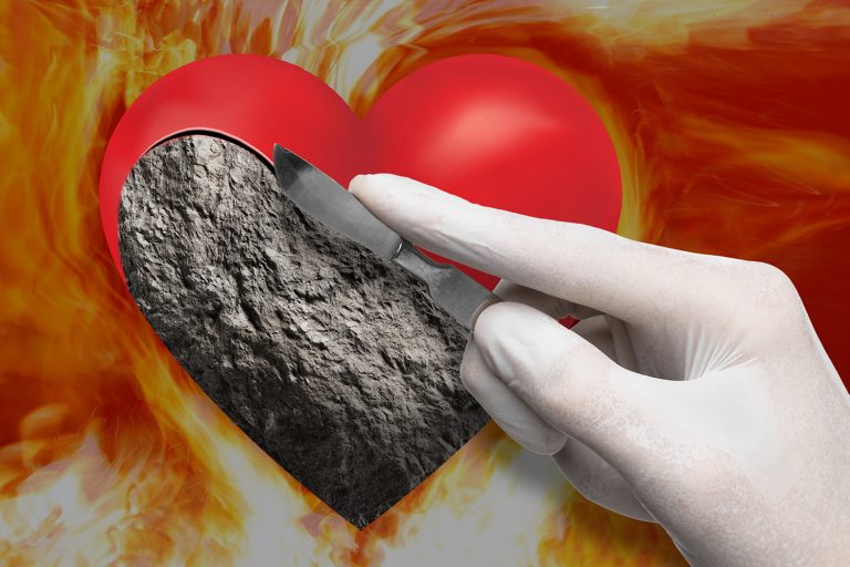 Circumcision What Does It Mean? Come And Reason Ministries